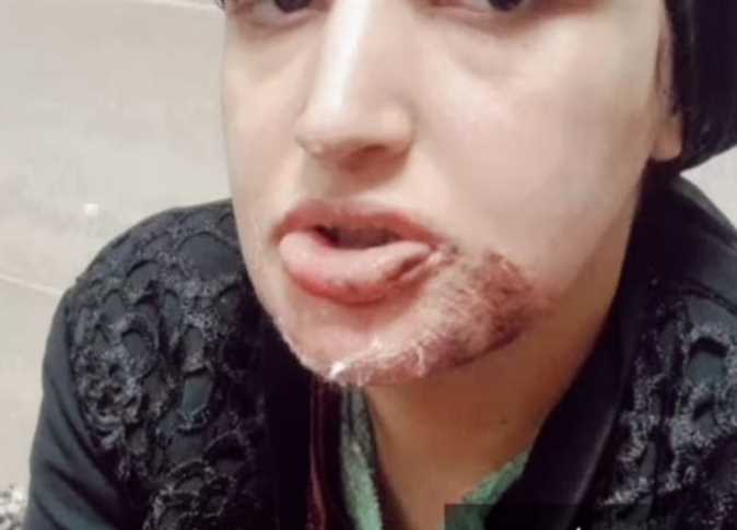 القبض على زوج اعتدى على زوجته بالضرب المبرح