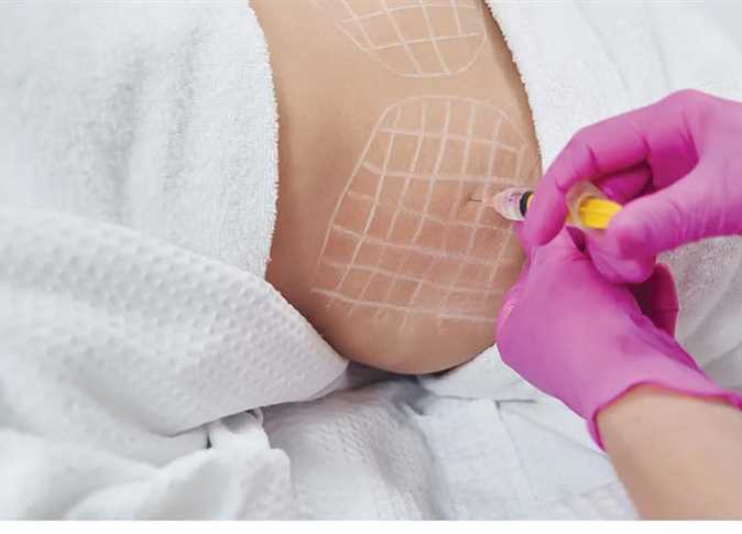 «بحقنة فيلر».. المشدد لصيدلي انتحل صفة طبيب وأنهى حياة شابة بالتجمع