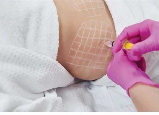 «بحقنة فيلر».. المشدد لصيدلي انتحل صفة طبيب وأنهى حياة شابة بالتجمع