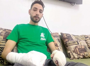 ضحية «عامل البلاي ستيشن»: «قطع أوتار إيدي وأصابني بعاهة»